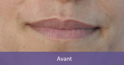 avant-1
