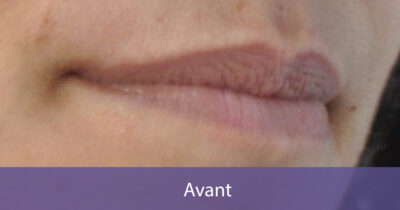 avant-2