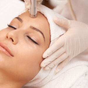 micro needling vivace